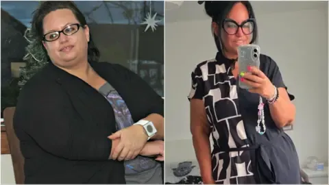 They Dropped Weight Using Injections – Followed By the Loose Skin